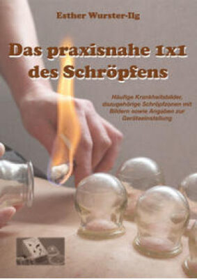 wurster-ilg-das-praxisnahe-1-x-1-des-schroepfens